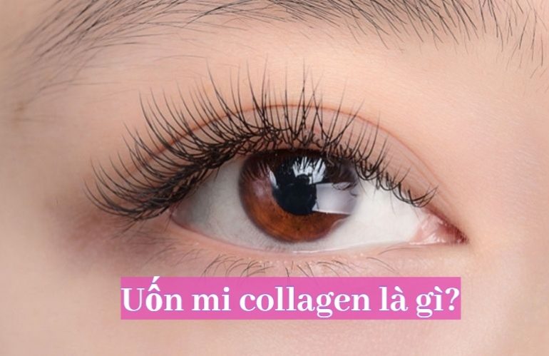 uốn mi collagen là gì